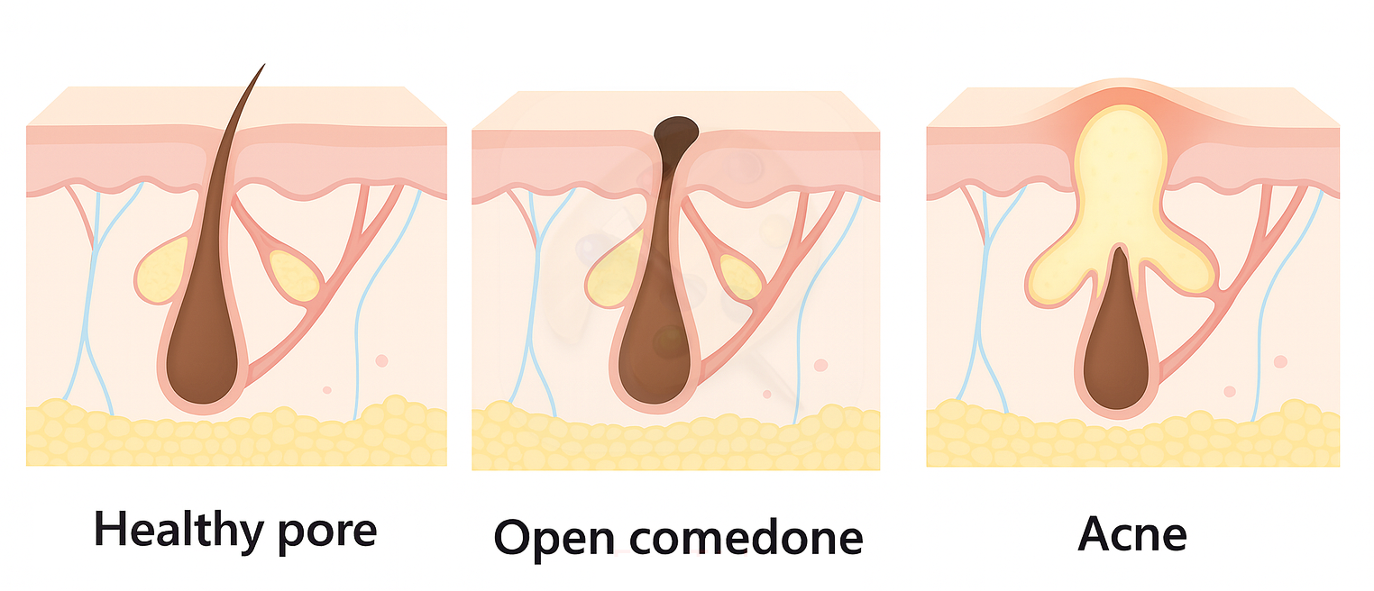 pores schematic